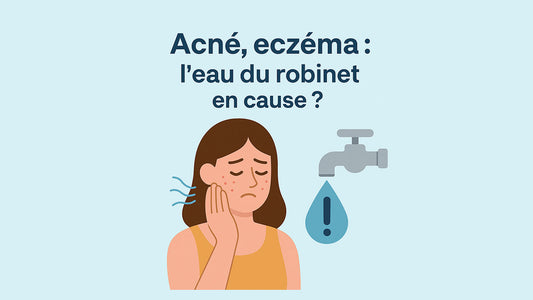 Acné, eczéma : l’eau du robinet en cause ?